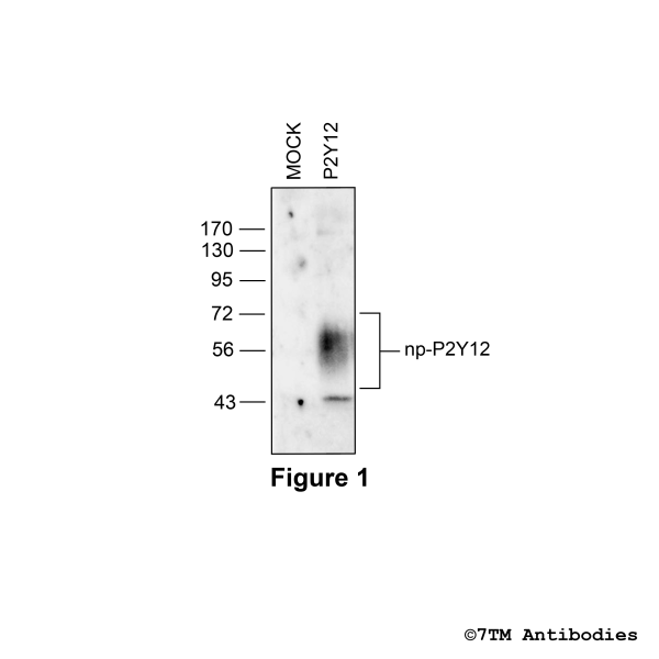 Validation of the P2Y Purinoceptor 12 in transfected HEK293 cells