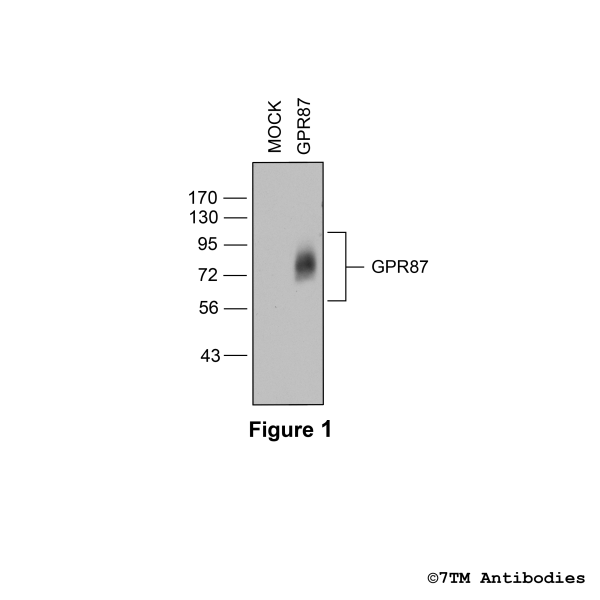 Validation of the G protein-coupled receptor 87 in transfected HEK293 cells.