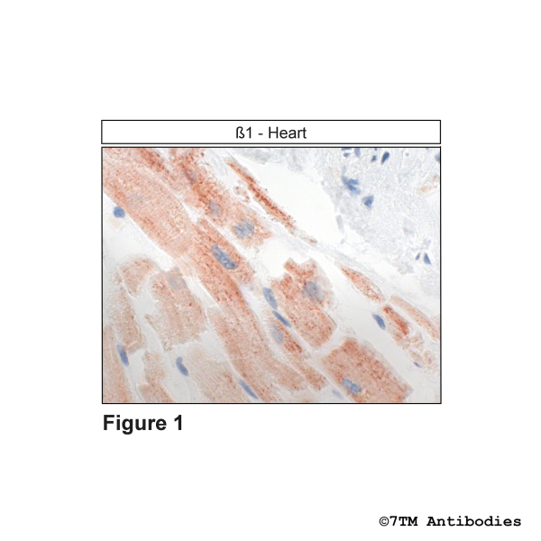  Immunohistochemical identification of ß1-Adrenoceptor in Heart
