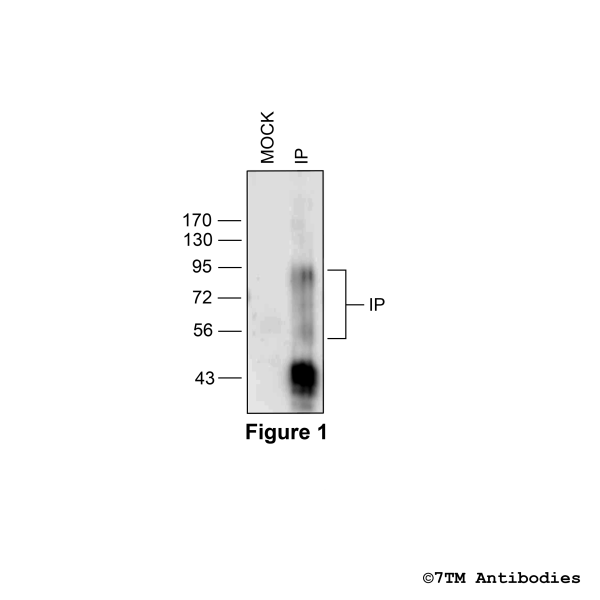 Validation of the IP Prostacyclin Receptor in transfected HEK293 cells