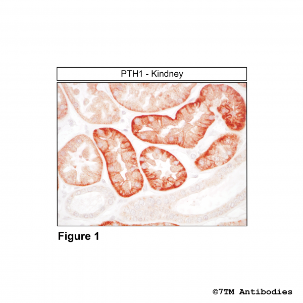 Immunohistochemical identification of Parathyroid Hormone Receptor 1 in human kidney.