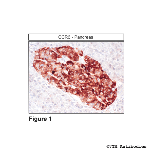 Immunohistochemical identification of CC Chemokine Receptor 6 in pancreas