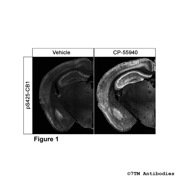 Immunohistochemical Identification of Agonist-induced Serine425 phosphorylation of the Cannabinoid Receptor 1 in mouse brain