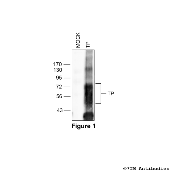 Validation of the TP Tromboxane Receptor in transfected HEK293 cells
