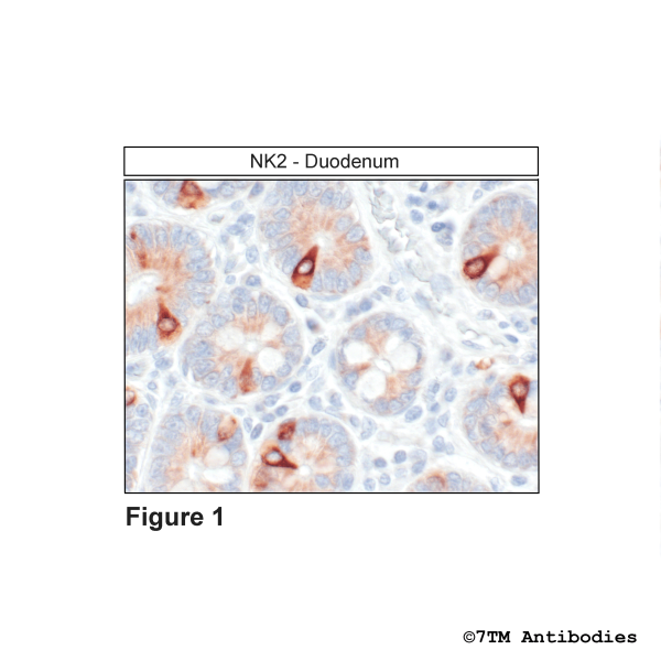 Immunohistochemical identification of Tachykinin Receptor 2 in duodenum