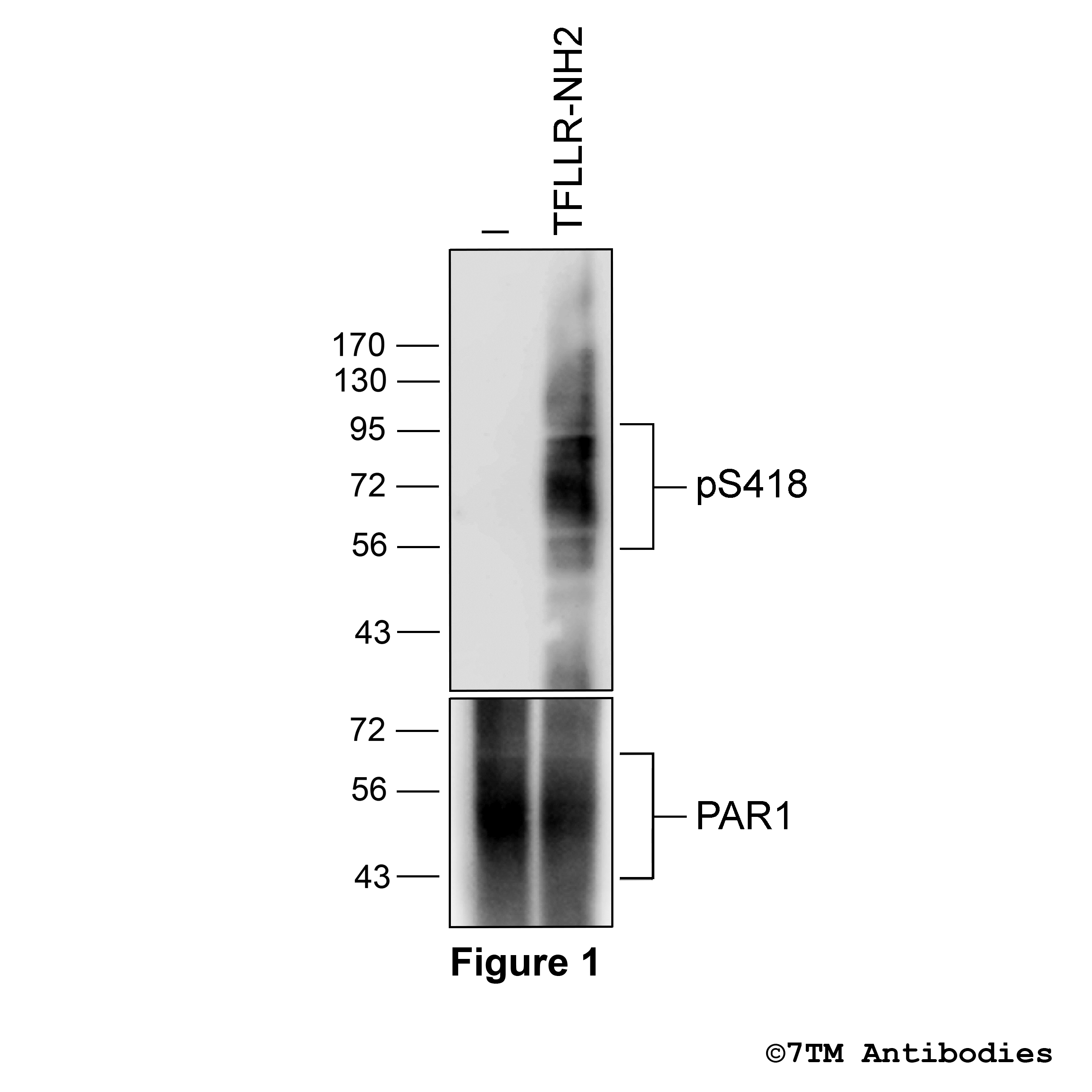 Proteinase-Aktivated Receptor 1 Antibodies | 7TM Antibodies