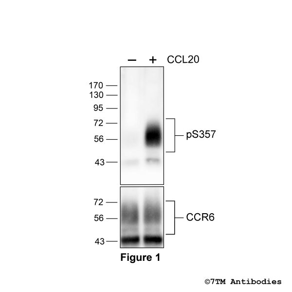 Agonist-induced Serine357 phosphorylation of the Chemokine Receptor 6