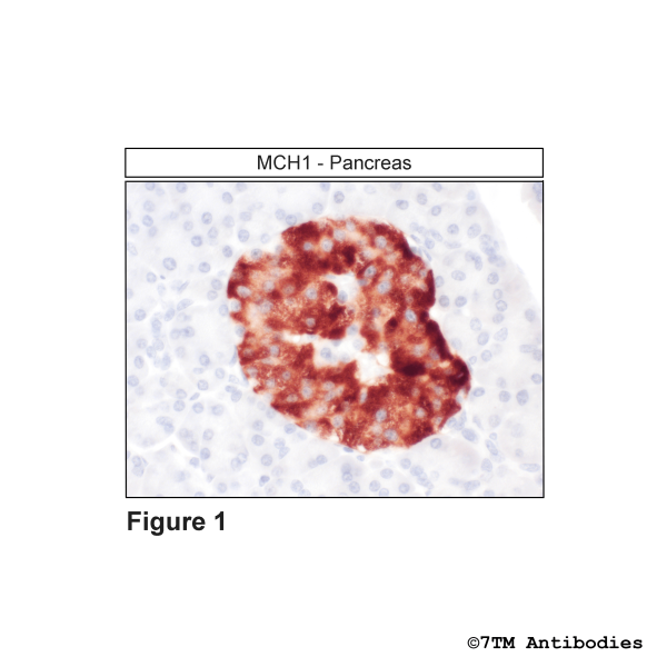 Immunohistochemical identification of Melanin-Concentrating Hormone Receptor 1 in pancreas