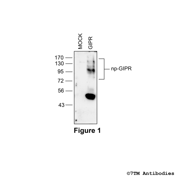 Validation of the Gastric Inhibitory Polypeptide Receptor in transfected HEK293 cells