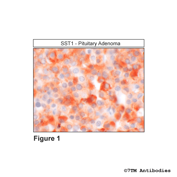 SST1 (IHC-grade), Somatostatin Receptor 1 Antibody