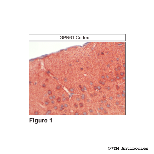 GPR61 (IHC-grade), G Protein-Coupled Receptor 61 Antibody